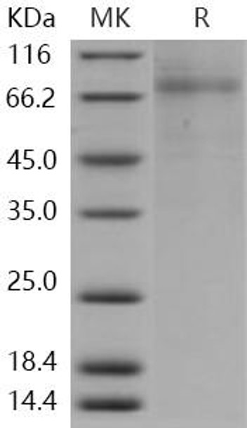 Human PLTP Recombinant Protein (RPES3175)