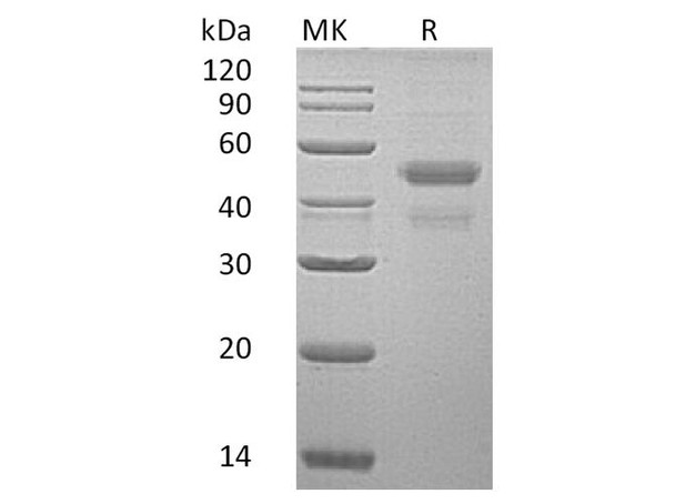 Human ERP44 Recombinant Protein (RPES3182)