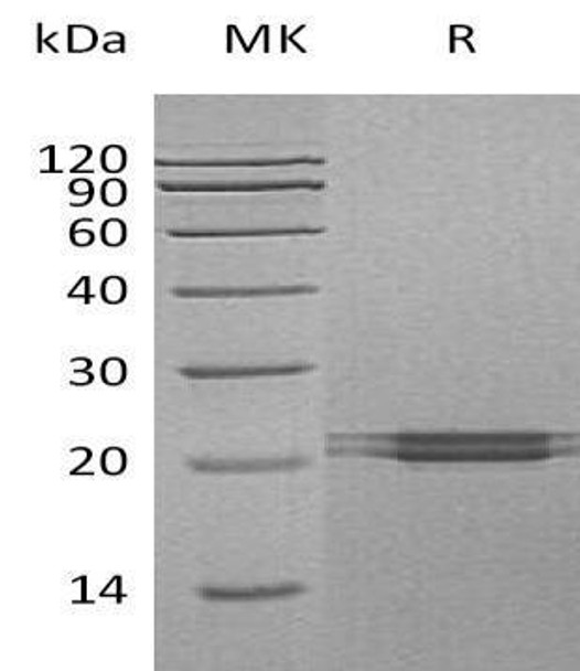 Human FAM3C Recombinant Protein (RPES3184)