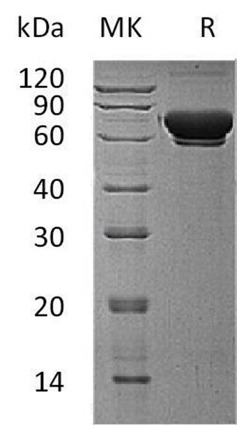 Human MAN1B1 Recombinant Protein (RPES3201)