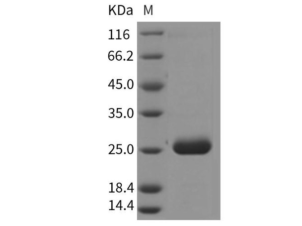 Rat PRL2A1/Prolactin-2A1 Recombinant Protein (RPES3215)