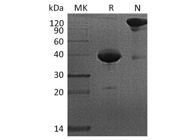 Cynomolgus BCMA/CD269 Recombinant Protein (RPES3231)