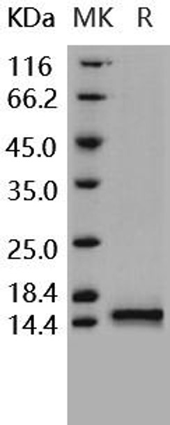 Human Cystatin B/CSTB Recombinant Protein (RPES3235)