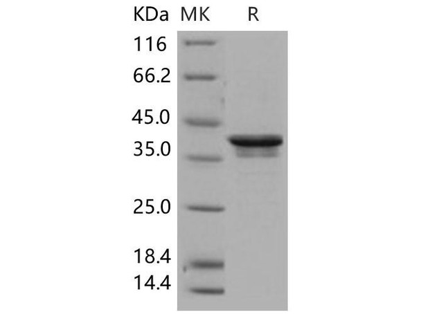 PDK/PDZ binding kinase/TOPK Recombinant Protein (RPES3240)