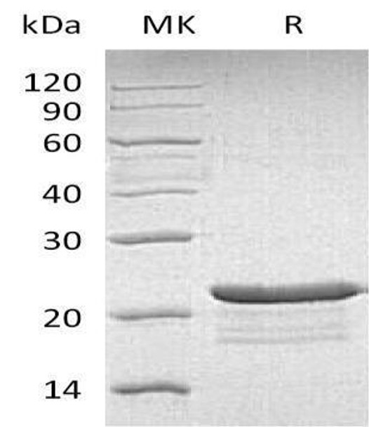 Human PPP1R14A Recombinant Protein (RPES3265)