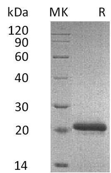 Mouse TIMP2/TIMP-2 Recombinant Protein (RPES3268)