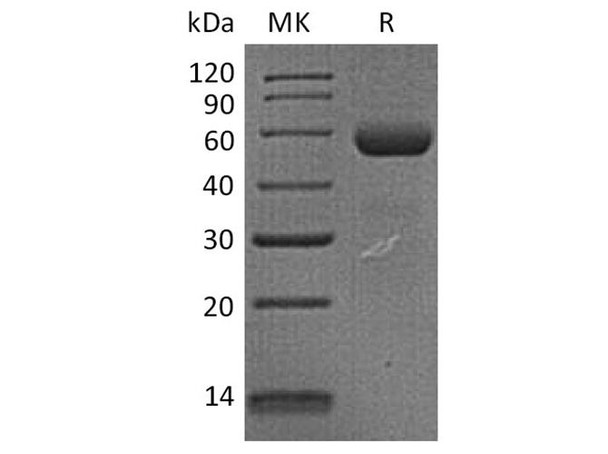 Human Dectin/CLEC7A Recombinant Protein (RPES3272)