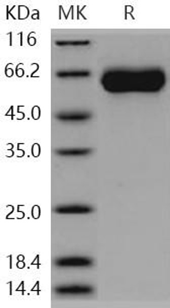 Human MGAT5/GGNT5 Recombinant Protein (RPES3280)