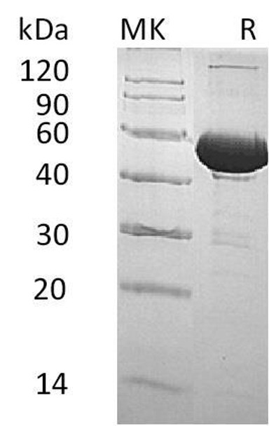 Human BPI/CAP57 Recombinant Protein (RPES3282)