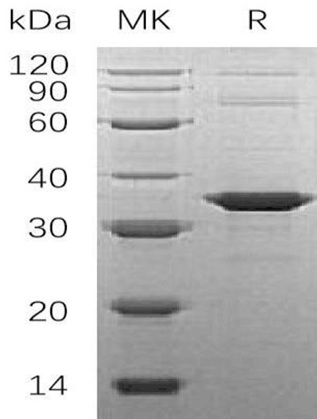 Human SNAP-alpha/NAPA Recombinant Protein (RPES3286)