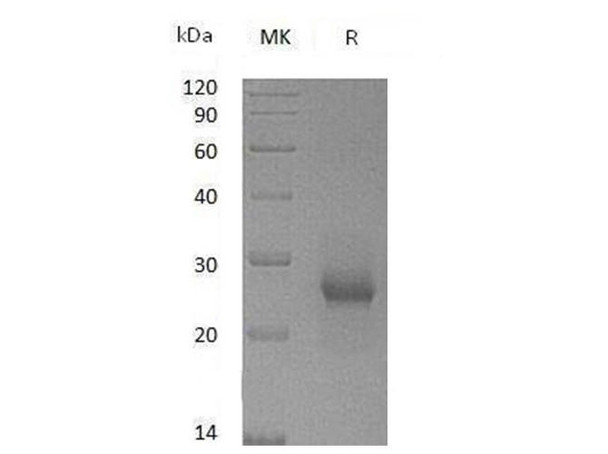 Mouse TIMP1/TIMP Recombinant Protein (RPES3288)