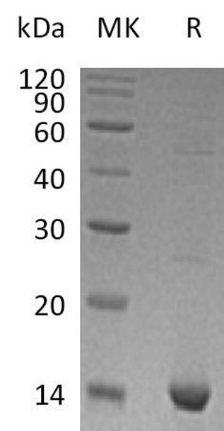 Human S100A9 Recombinant Protein (RPES3295)