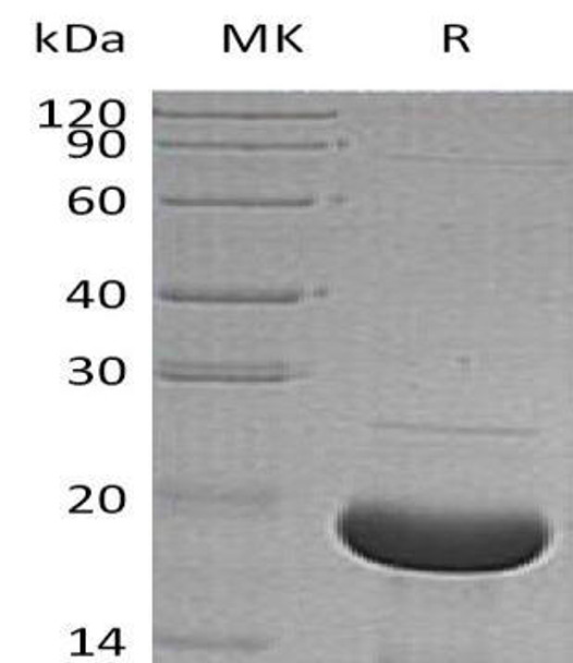 Human Alpha-Synuclein/SNCA Recombinant Protein (RPES3306)