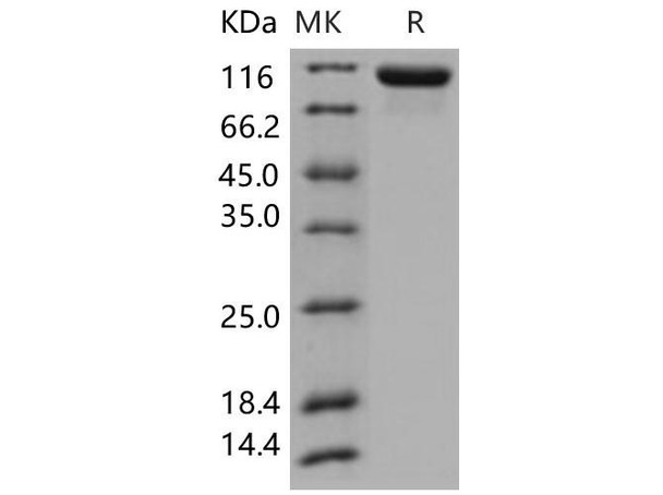 Human Tie2/CD202b Recombinant Protein (RPES3321)