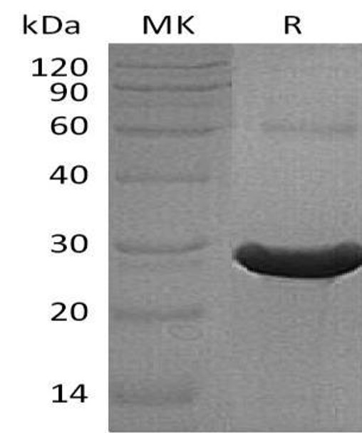 Human TXLNA Recombinant Protein (RPES3326)