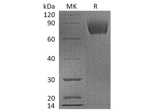 Cynomolgus B7-H3/CD276 Recombinant Protein (RPES3333)