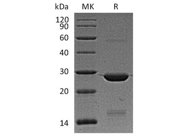 Human BAG2 Recombinant Protein (RPES3381)