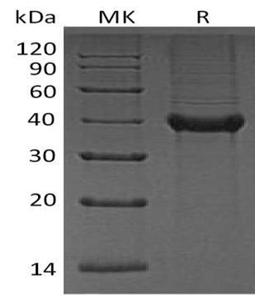 Human B4GALT4 Recombinant Protein (RPES3385)