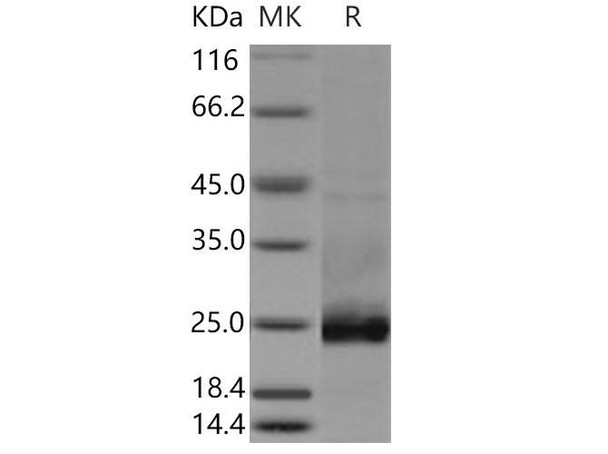 Mouse Podoplanin/PDPN Recombinant Protein (RPES3397)