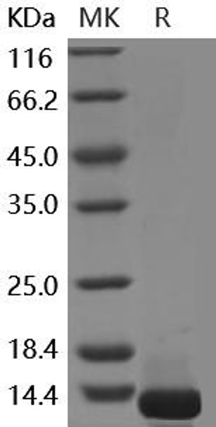 Human COL6A3/Collagen-VI Recombinant Protein (RPES3398)