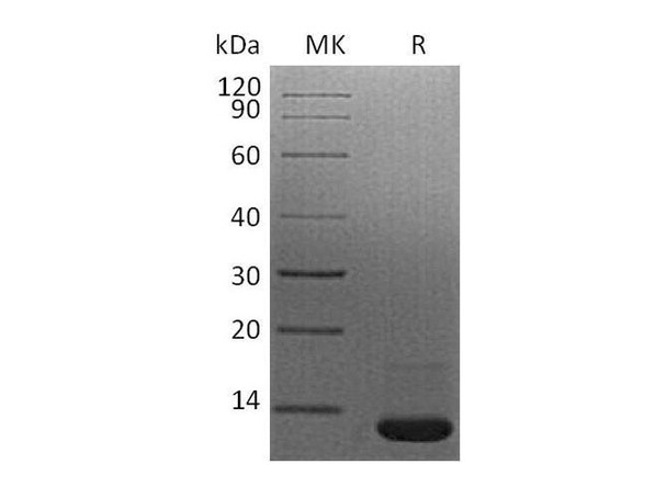 Mouse TGFbeta1/TGFB1 Recombinant Protein  (RPES3406)