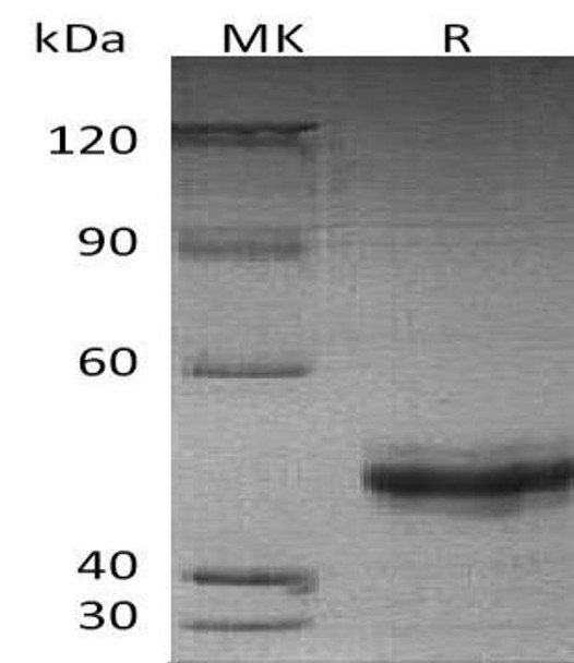 Human EIF5A2 Recombinant Protein (RPES3421)