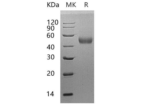 Human Beta-Arrestin 1/ARRB1 Recombinant Protein (RPES3444)