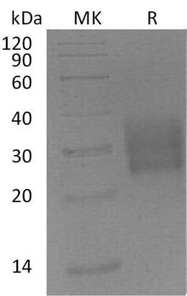 Mouse TGFBR2 Recombinant Protein (RPES3446)