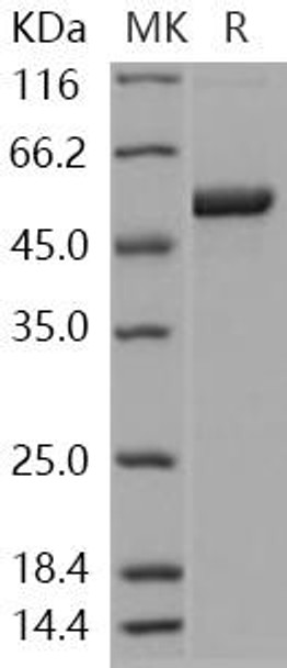 Human S100A3/S100E Recombinant Protein (RPES3455)