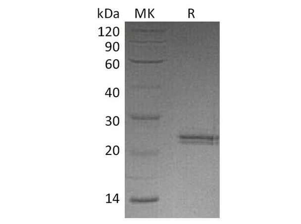 Human CNTF Recombinant Protein  (RPES3472)