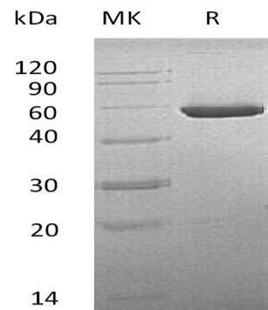 Mouse CNDP2/CPGL/PEPA Recombinant Protein (RPES3480)