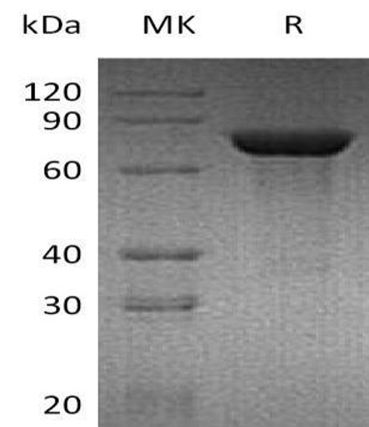 Mouse TGM2 Recombinant Protein (RPES3489)