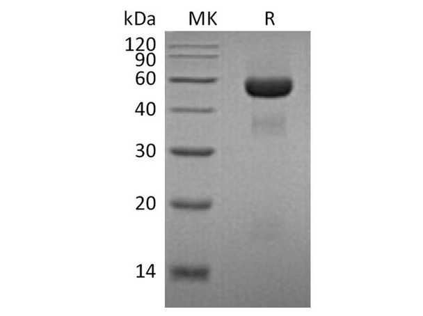 Human Urokinase/uPA Recombinant Protein (RPES3492)