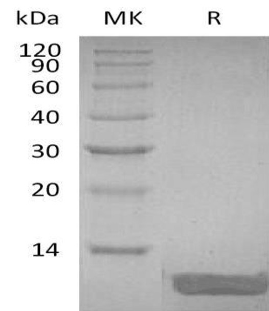Human DEFB104A Recombinant Protein (RPES3507)