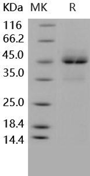 Human TRAILR1/TNFRSF10A Recombinant Protein (RPES3518)