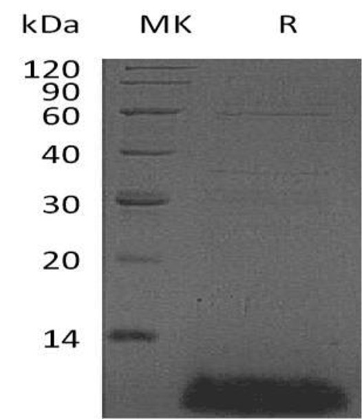 Alpha-Defensin 4A/DEFB4A Recombinant Protein (RPES3528)