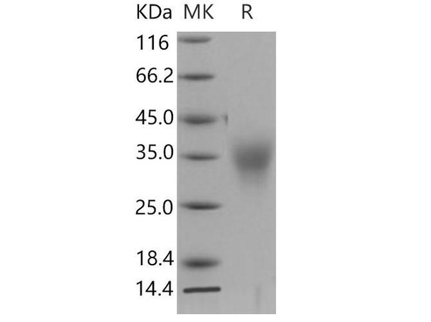 Mouse ACVR2B Recombinant Protein (RPES3529)