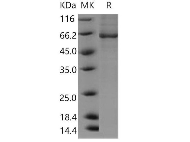 Human BBOX1/Gamma-BBH Recombinant Protein (RPES3536)