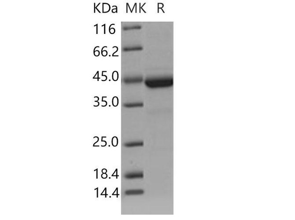 Mouse Cystatin 7/CST7 Recombinant Protein (RPES3541)