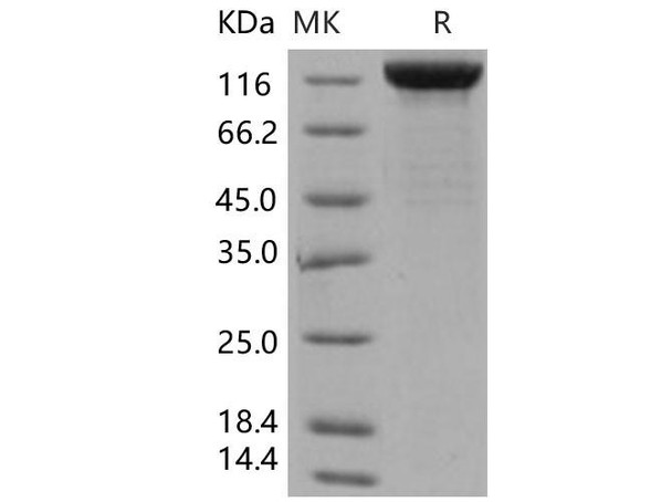 Human LIFR/CD118 Recombinant Protein (RPES3543)