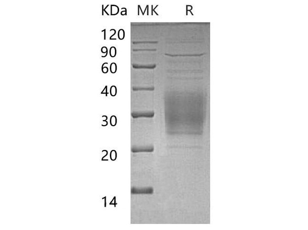 Mouse TREM2 Recombinant Protein (RPES3550)