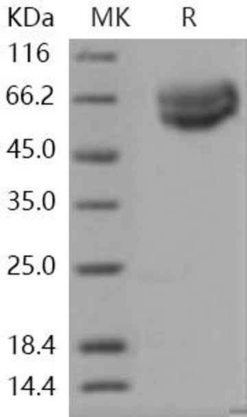 Human IL18R1/CD218a Recombinant Protein (RPES3559)