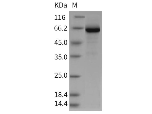 Rat GP1BB/CD42c Recombinant Protein (RPES3561)