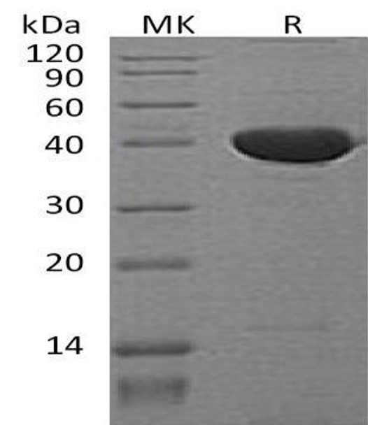 Mouse Serpin F1/PEDF Recombinant Protein (RPES3563)