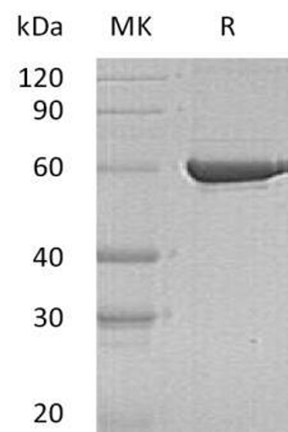 Human PKLR Recombinant Protein (RPES3569)