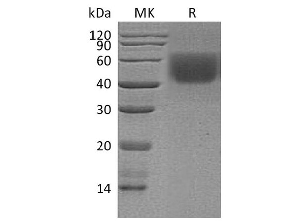 Human CD86/B7-2 Recombinant Protein (RPES3596)