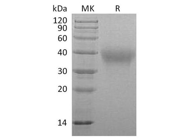 Marmoset TIM-3/HAVCR2 Recombinant Protein (RPES3597)