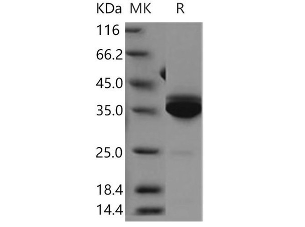 Human Statherin/STATH Recombinant Protein (RPES3605)