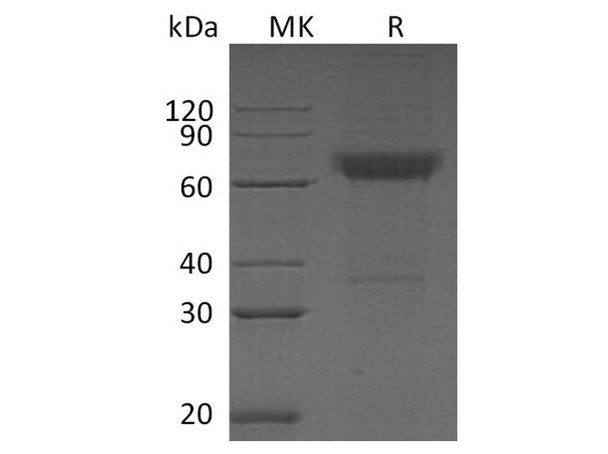 Human CD16b/FCGR3B Recombinant Protein (RPES3608)