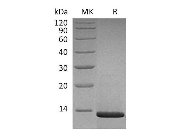 Human Beta-NGF/NGFB Recombinant Protein (RPES3611)